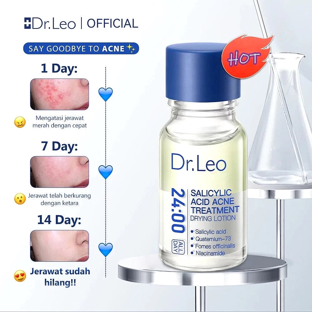 🎉🎉60% OFF This Week Promotions🔥Salicylic Acid Acne Treatment Drying Lotion