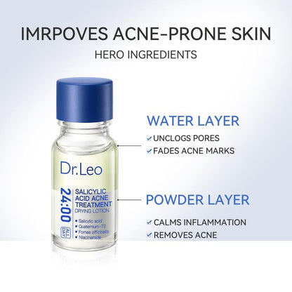 🎉🎉60% OFF This Week Promotions🔥Salicylic Acid Acne Treatment Drying Lotion