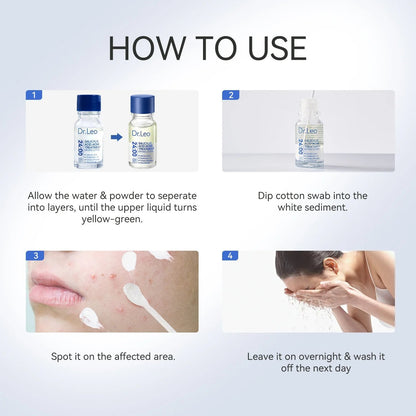 🎉🎉60% OFF This Week Promotions🔥Salicylic Acid Acne Treatment Drying Lotion